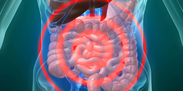 Kolon Kanseri Tedavisi