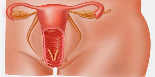 Rahim Ağzı Kanseri Tedavisi